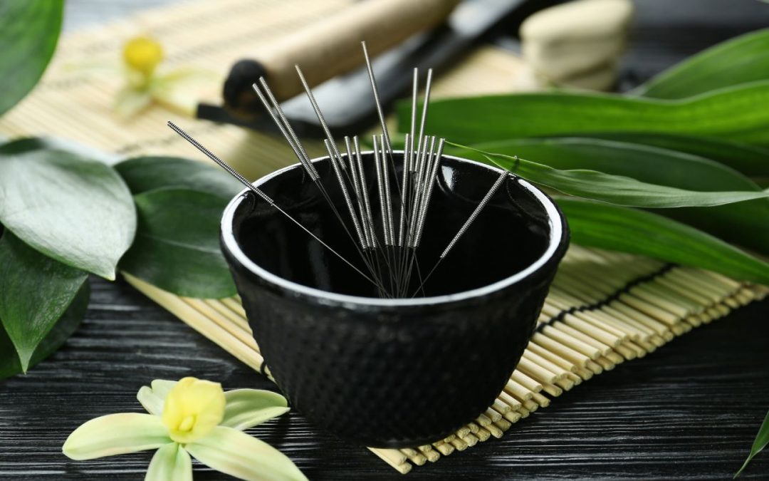How Do You Know If Acupuncture Is Working? Key Signs and Tips