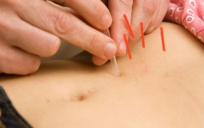 When to Get Acupuncture for Fertility: A Best Practices Guide