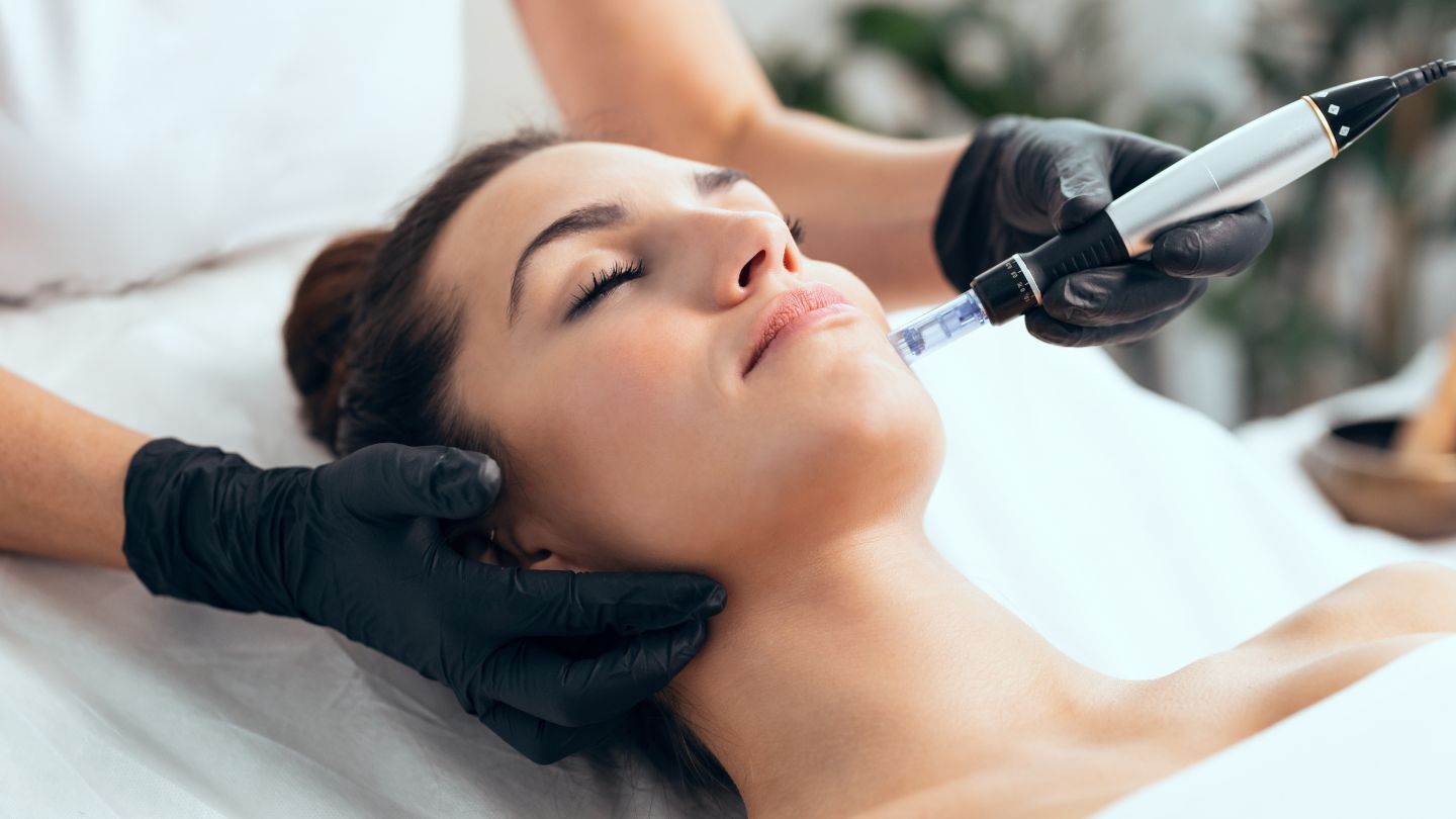 How Many Sessions of Microneedling Do I Need For Acne Scars?
