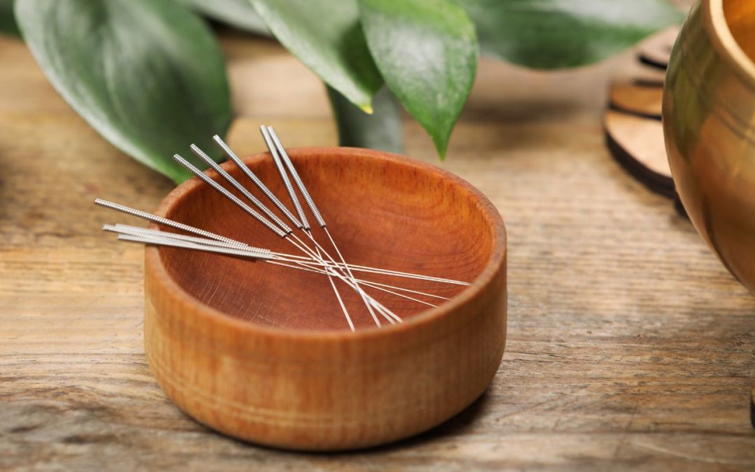 What to Expect from Your First Facial Acupuncture Session in Atlanta