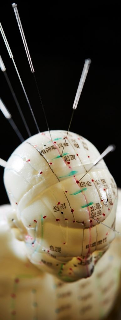 Needle Placement On Acupuncture Dummy