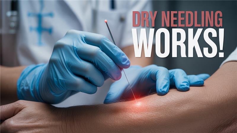 Top Dry Needling Benefits for Body Pain Relief