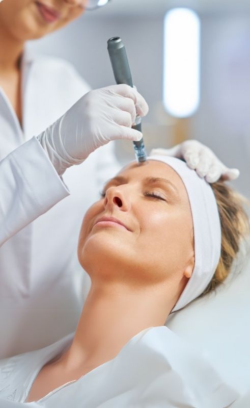 Woman Receiving Microneedling Treatment
