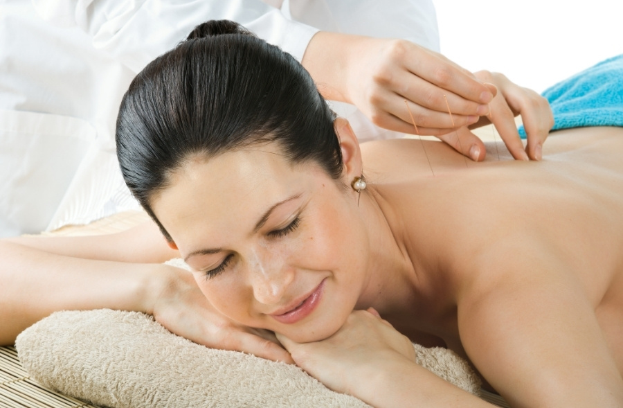Woman Relaxing During Acupuncture