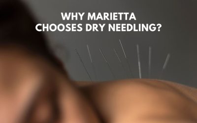 Why More People Are Choosing Dry Needling Over Pain Meds in Marietta?