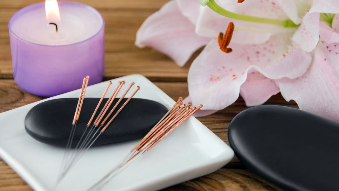 The Ultimate Guide to Acupuncture for Children and Teens