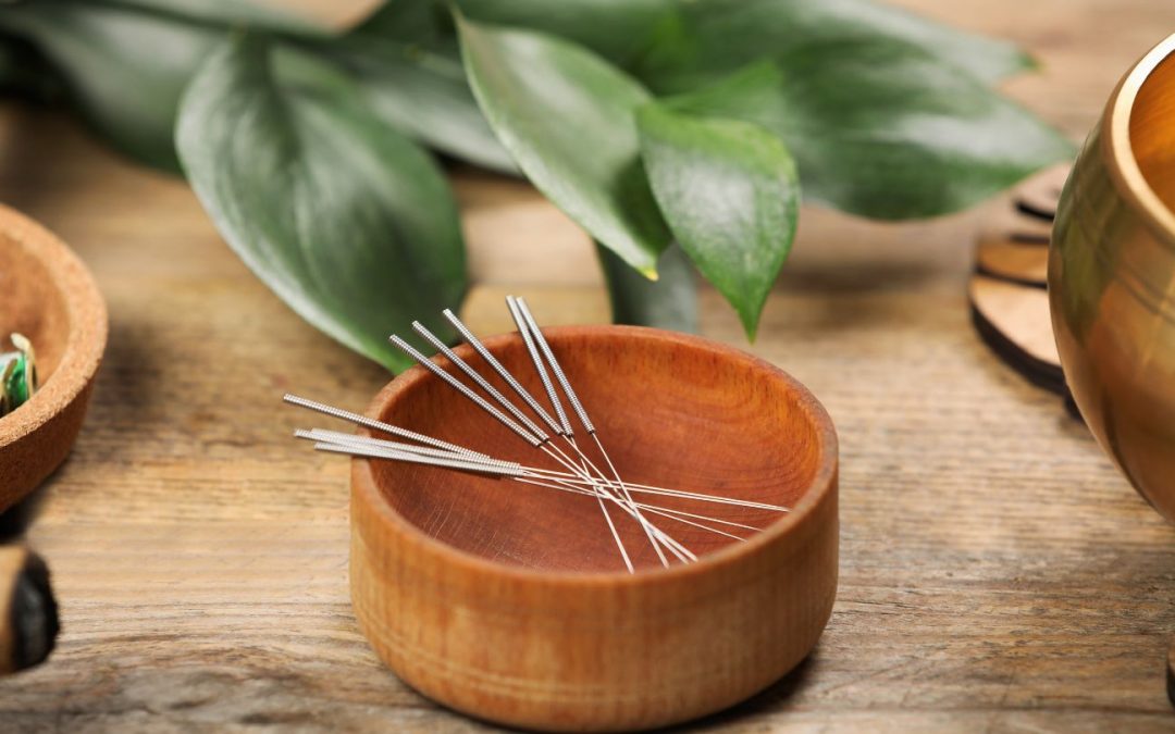 How Does Acupuncture for Sciatica Help Relieve Pain?